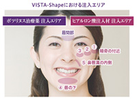 ビスタシェイプ