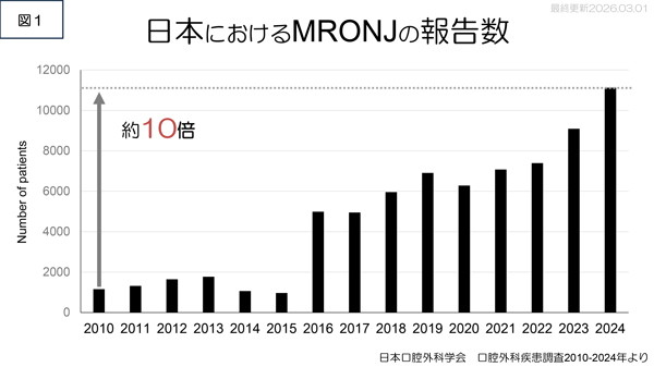 MRONJ専門外来①