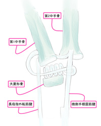 関節形成術②